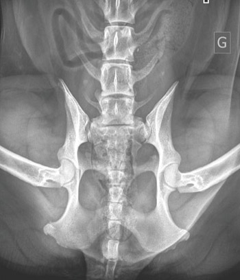 Radiographie des vertèbres lombo-sacrées (VTL)